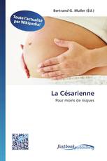 La Césarienne