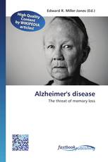 Alzheimer's disease