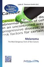 Melanoma