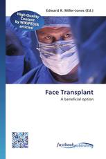 Face Transplant