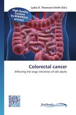Colorectal cancer