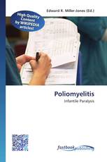 Poliomyelitis