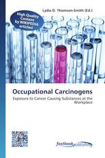 Occupational Carcinogens