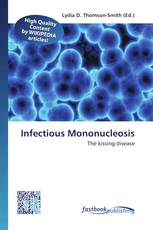Infectious Mononucleosis