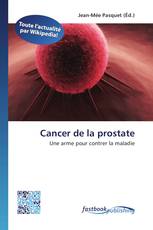 Cancer de la prostate