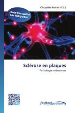 Sclérose en plaques