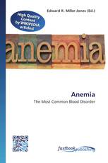 Anemia