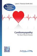 Cardiomyopathy