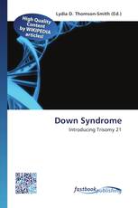 Down Syndrome