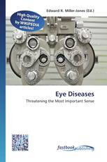 Eye Diseases