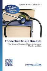 Connective Tissue Diseases