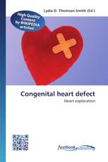 Congenital heart defect
