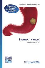 Stomach cancer
