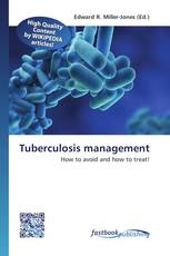 Tuberculosis management
