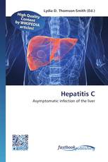 Hepatitis C