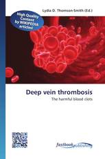 Deep vein thrombosis