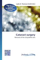 Cataract surgery