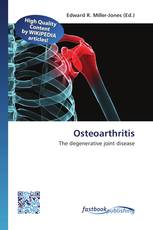Osteoarthritis