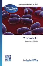Trisomie 21