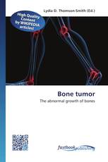 Bone tumor