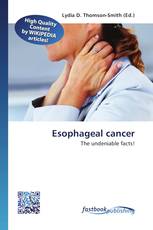 Esophageal cancer