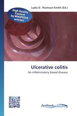 Ulcerative colitis