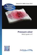 Pressure ulcer