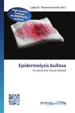 Epidermolysis bullosa
