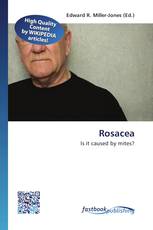 Rosacea