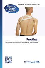 Prosthesis