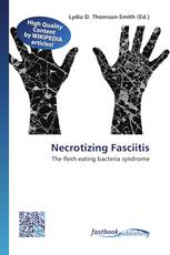 Necrotizing Fasciitis