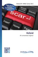 Keloid