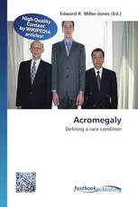 Acromegaly