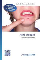 Acne vulgaris