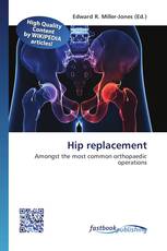 Hip replacement