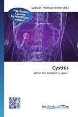 Cystitis