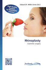 Rhinoplasty