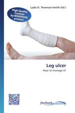 Leg ulcer