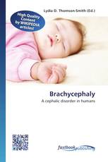 Brachycephaly
