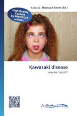 Kawasaki disease