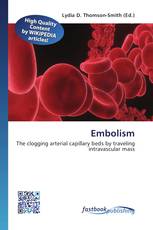 Embolism