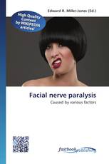 Facial nerve paralysis