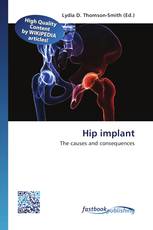 Hip implant