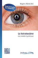Le kératocône