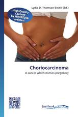 Choriocarcinoma