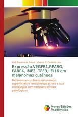 Expressão VEGFR1,PPARG, FABP4, IMP3, TFE3, IFI16 em melanomas cutâneos