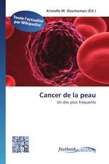 Cancer de la peau