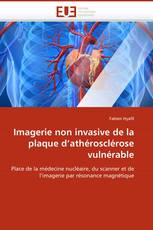 Imagerie non invasive de la plaque d''athérosclérose vulnérable