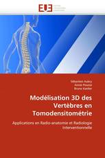 Modélisation 3D des Vertèbres en Tomodensitométrie