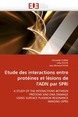 Etude des interactions entre protéines et lésions de l''ADN par SPRi